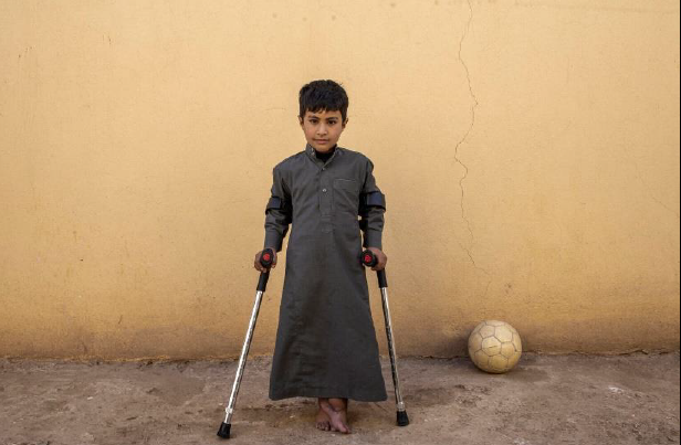 child on crutches against beige wall